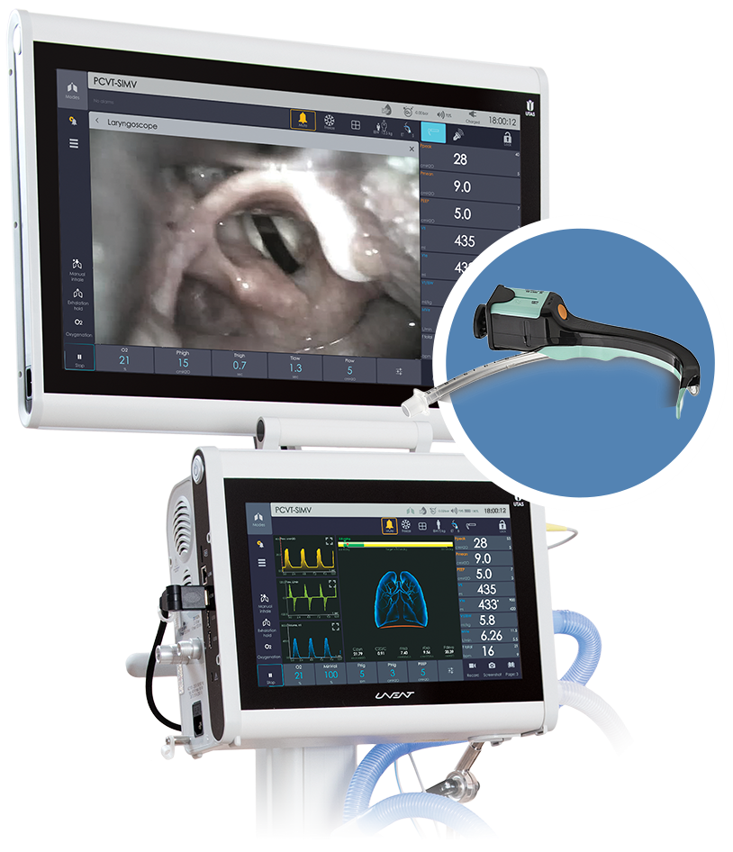 Intubation Support Tool