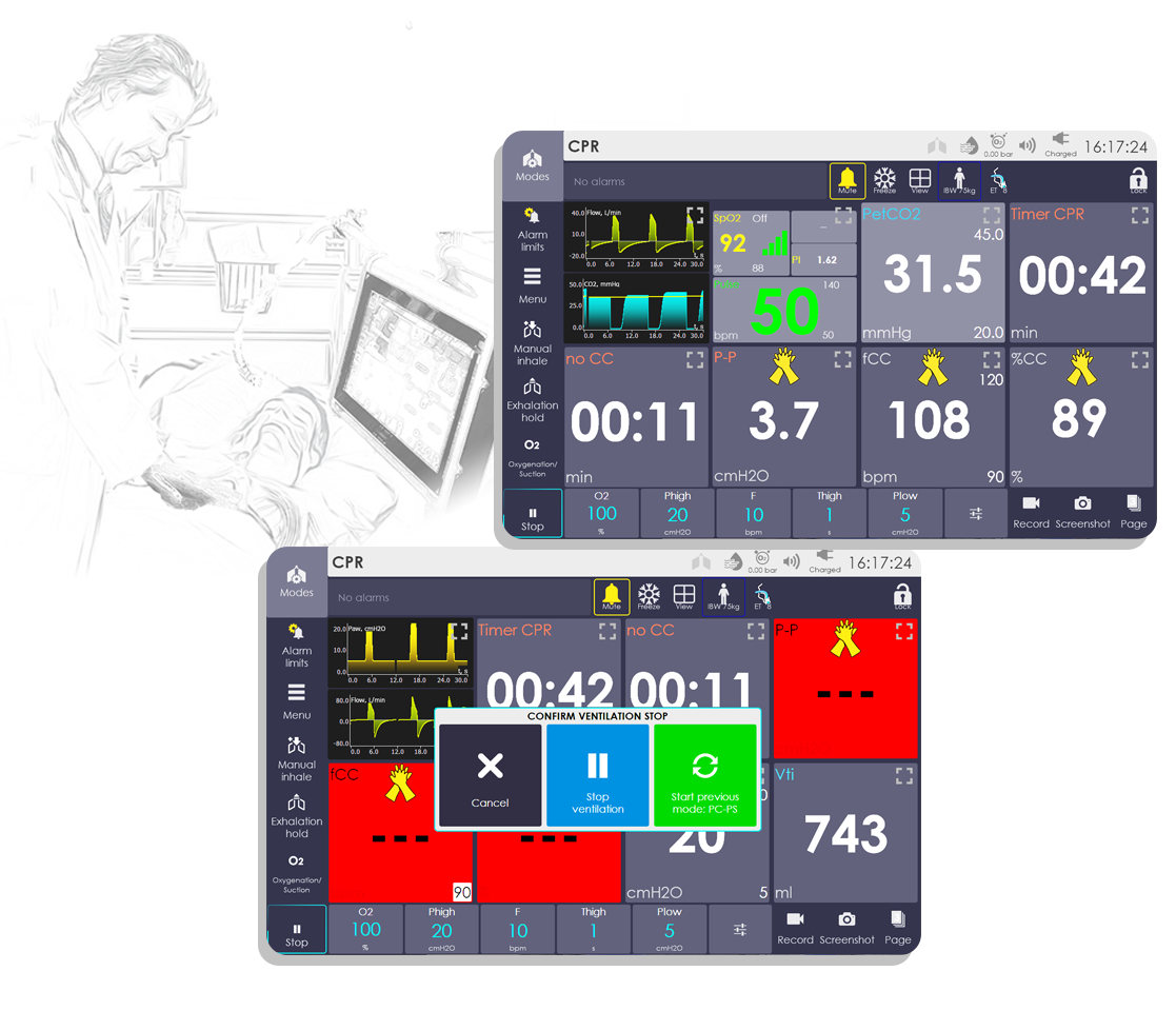 CPR mode in UVENT-S ventilators