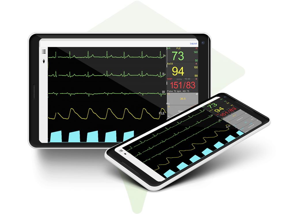 UviViewer remote patient monitoring