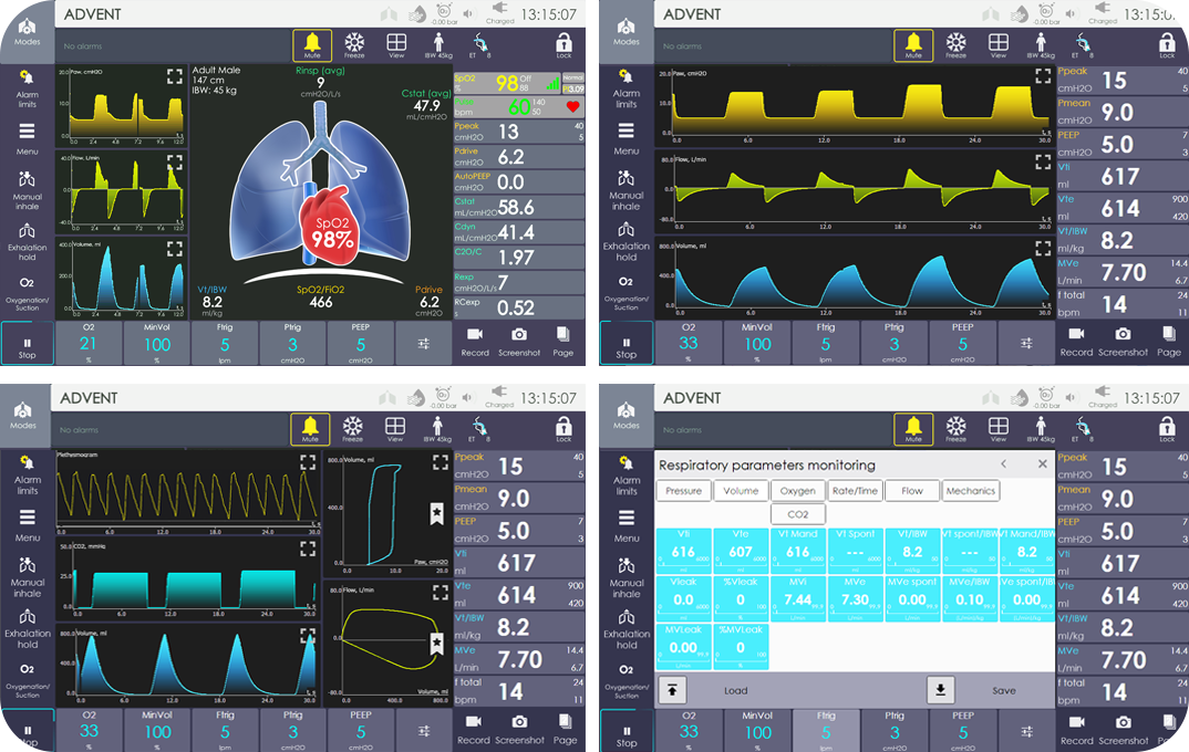 icu ventilator uvent user-friendly interface