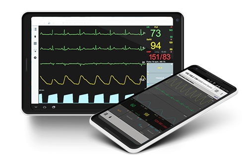 Remote patient monitoring UniViewer