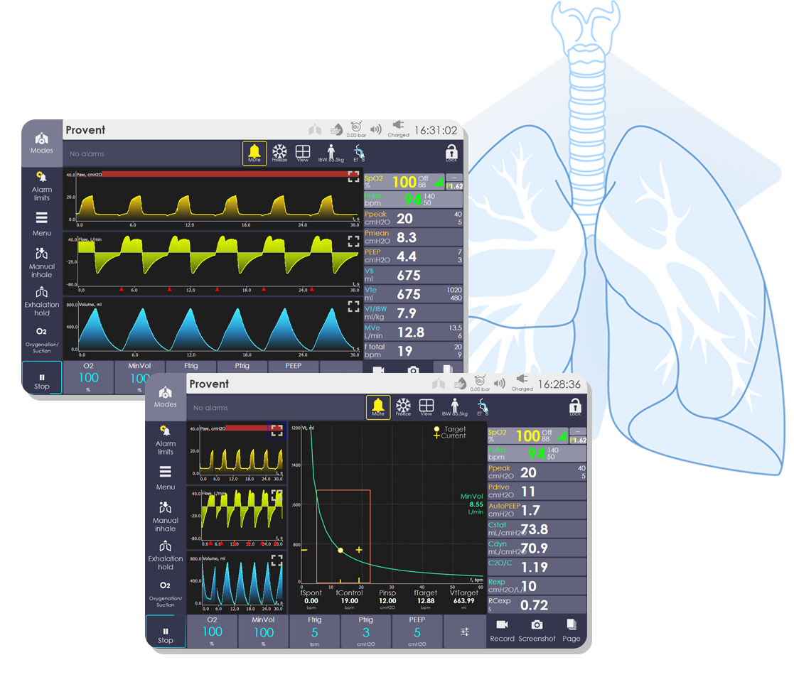 intelligent ventilation modes, mechanical ventilation
