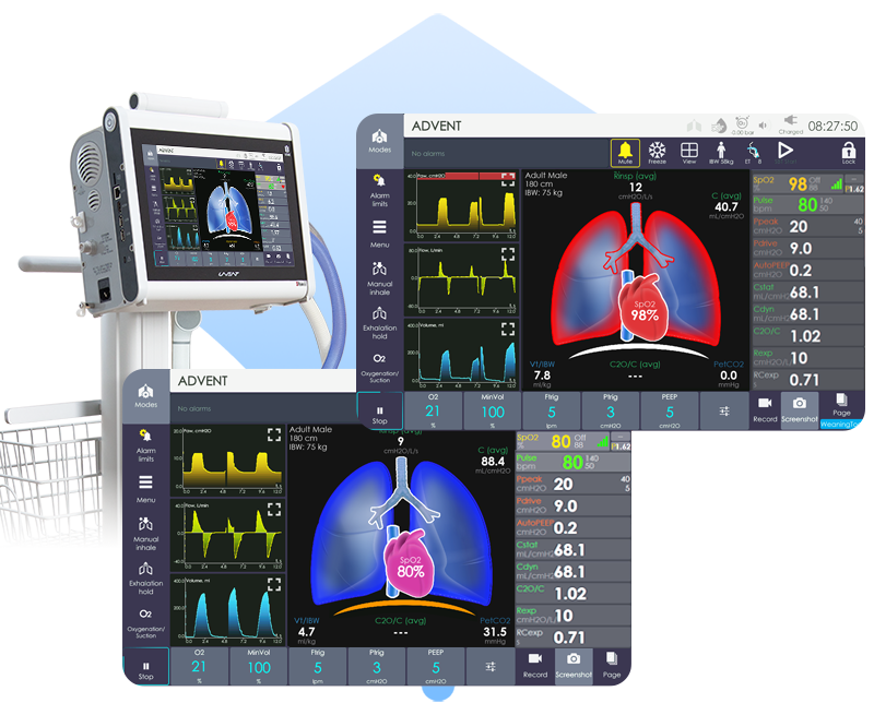 Lung Monitor Widget in ICU ventilator UVENT